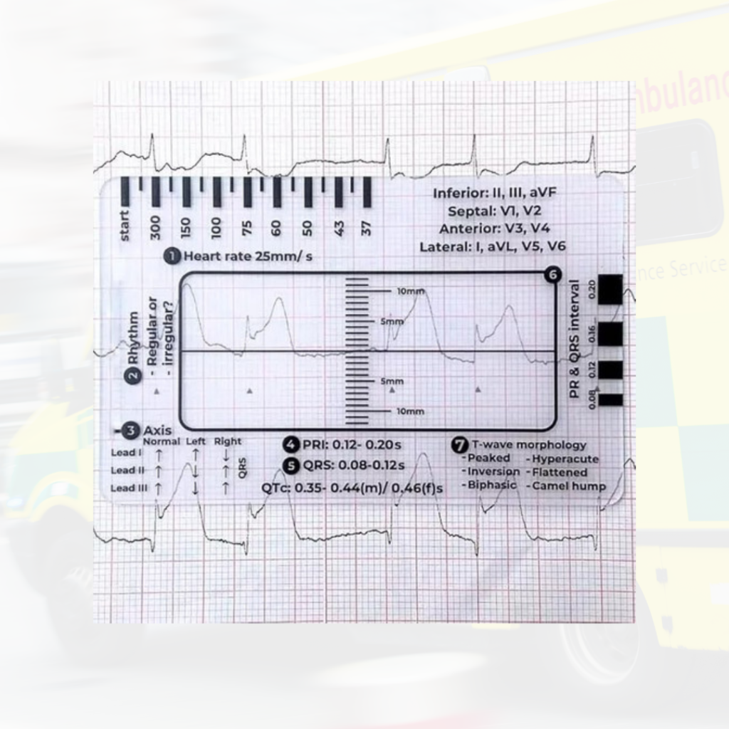 ECG Ruler Card
