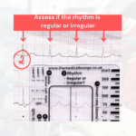 ECG Ruler Card