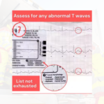 ECG Ruler Card